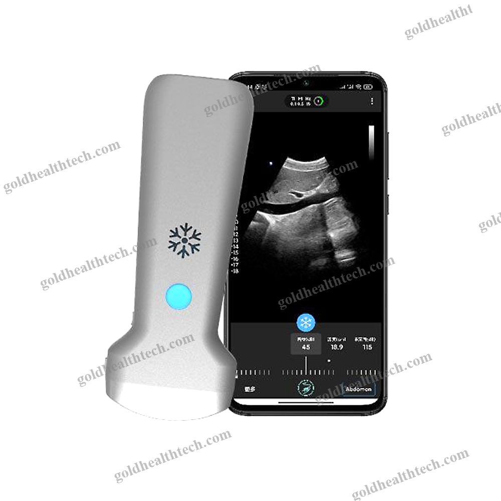 Hand-Held Ultrasound System
