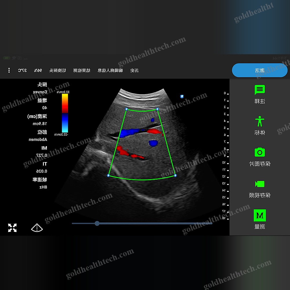 Hand-Held Ultrasound System