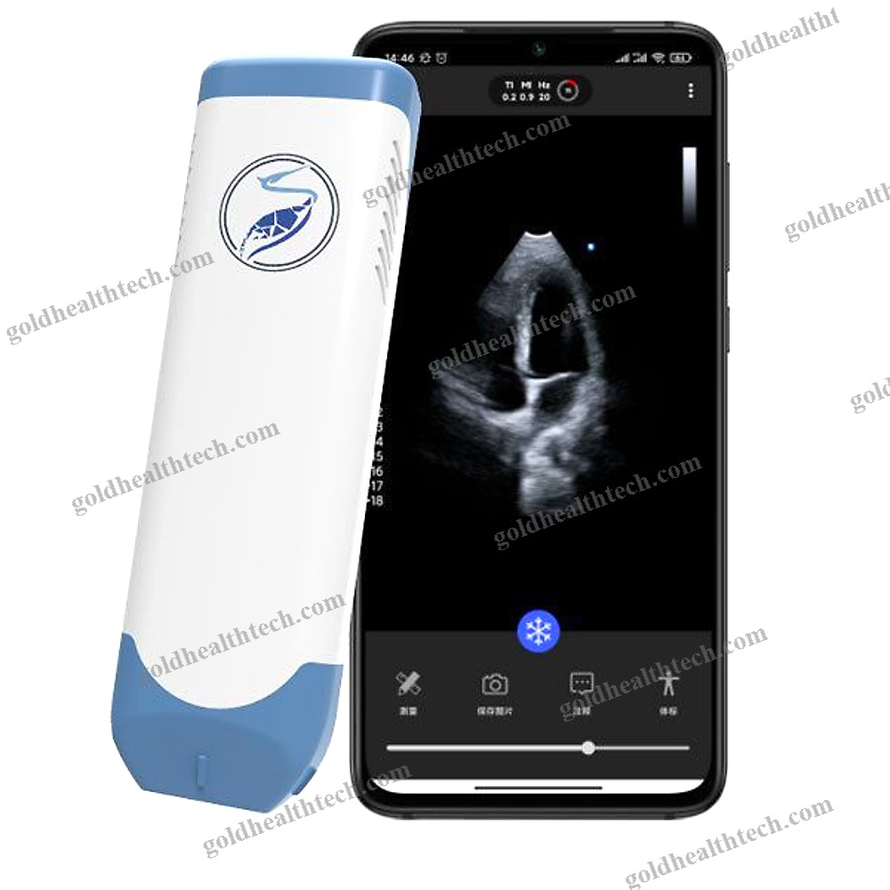 Hand-Held Ultrasound System