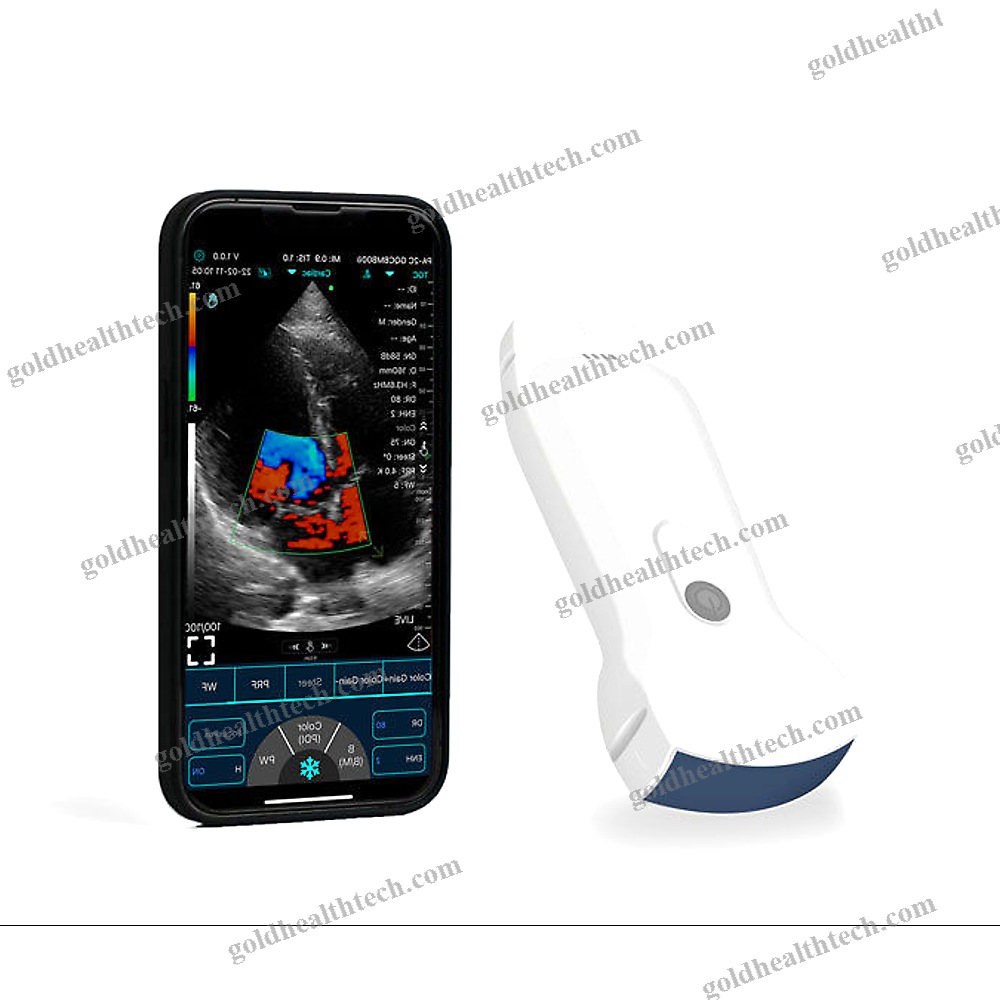Hand-Held Ultrasound System