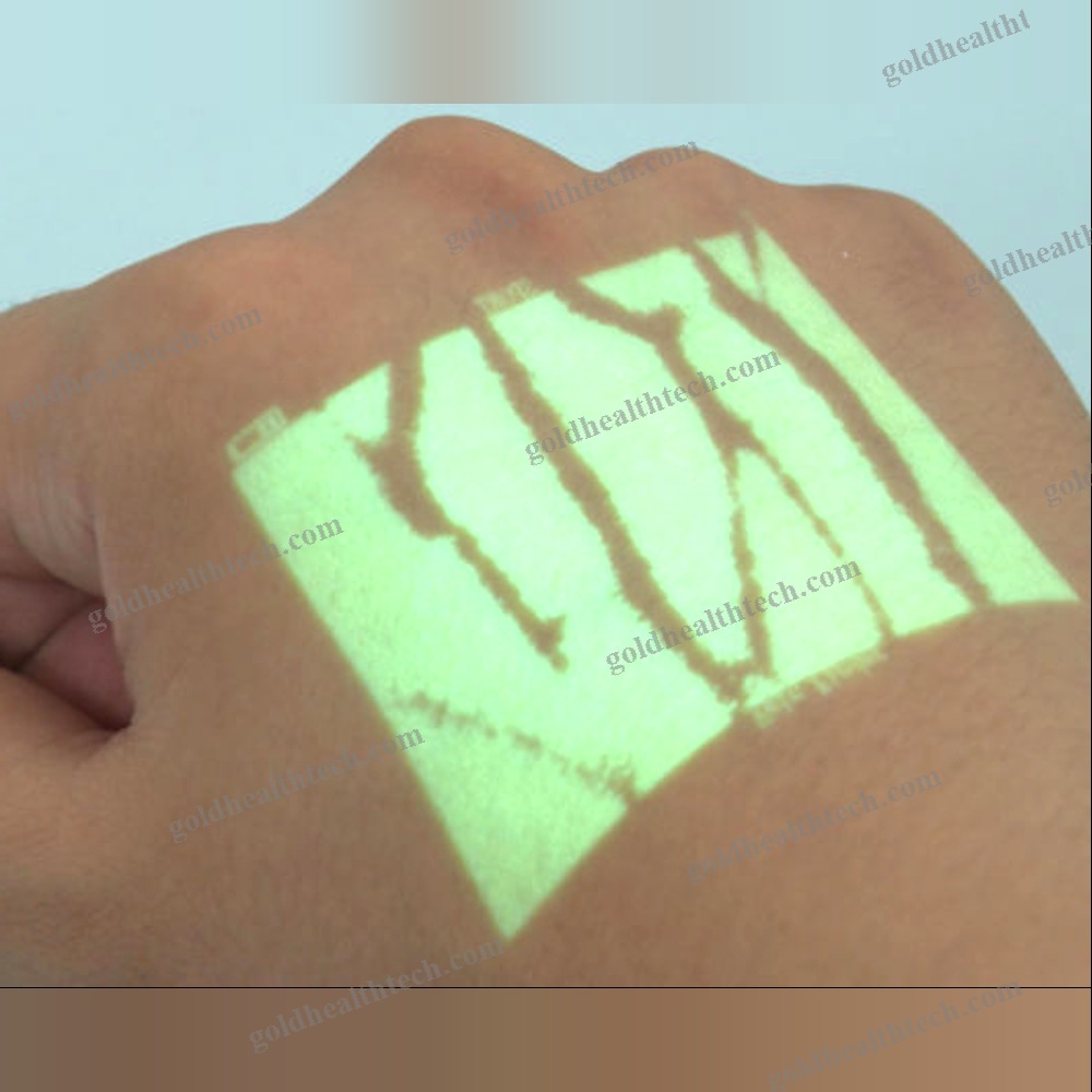 Infrared Vein Finder
