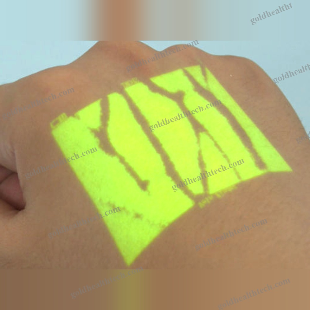 Infrared Vein Finder