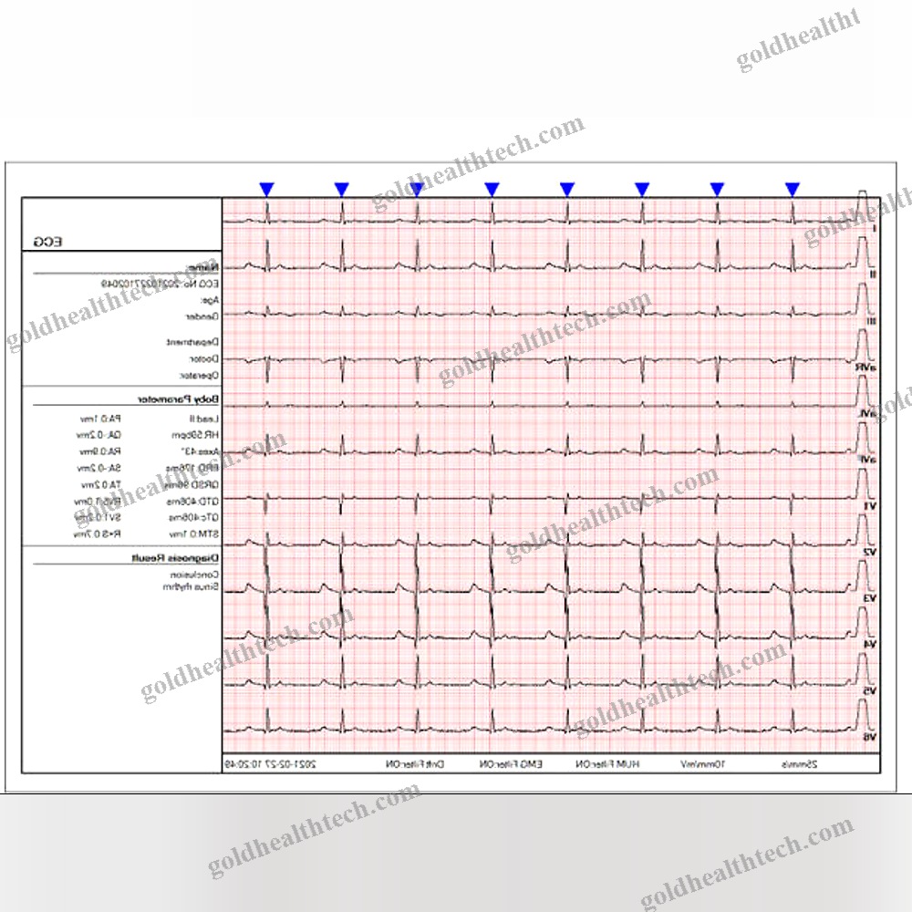 12-Channel Veterinary Ecg System