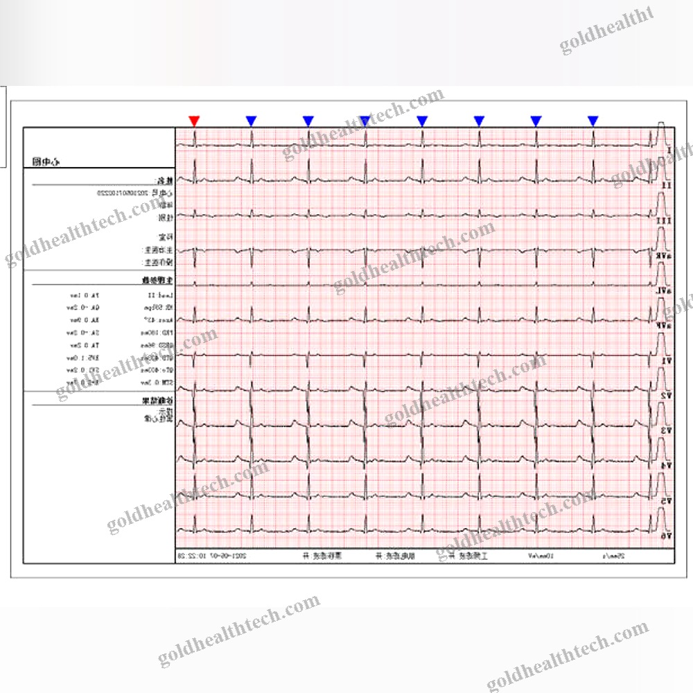 12-Channel Veterinary Ecg System