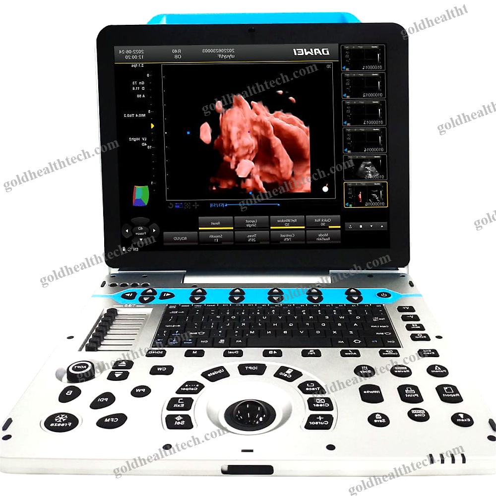 Color Doppler Ultrasound System