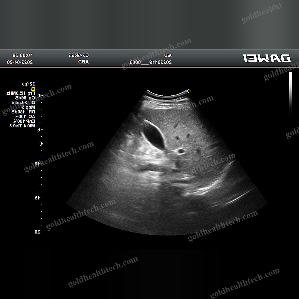 Color Doppler Ultrasound System