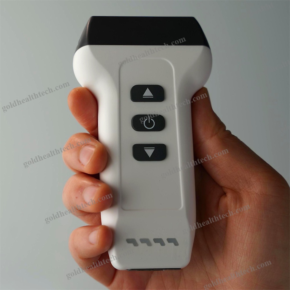 Hand-Held Ultrasound System