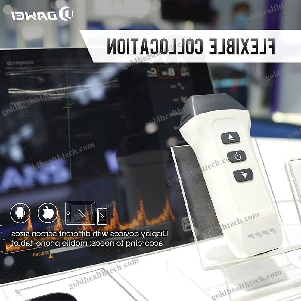 Hand-Held Ultrasound System