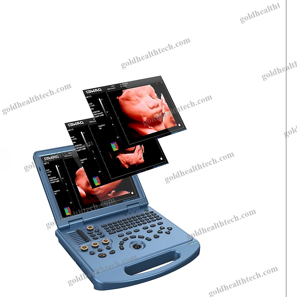 Portable Ultrasound System