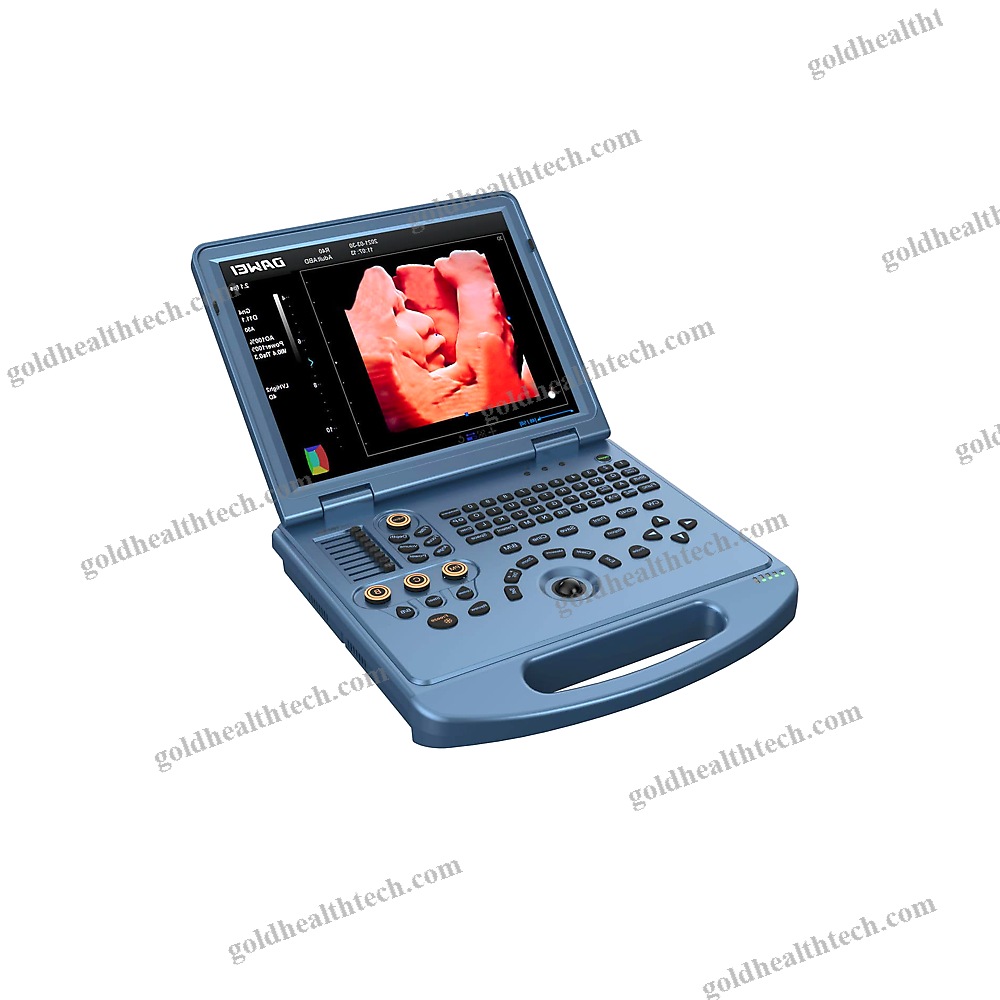 Portable Ultrasound System