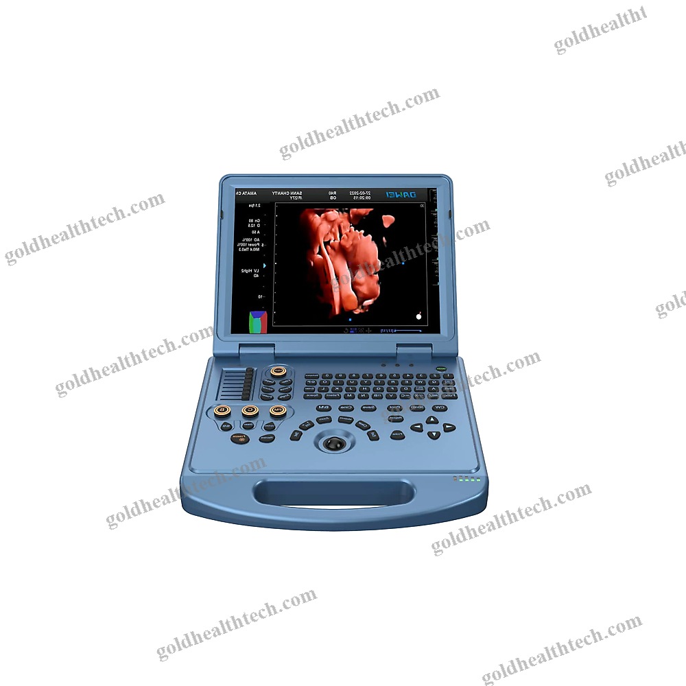Portable Ultrasound System