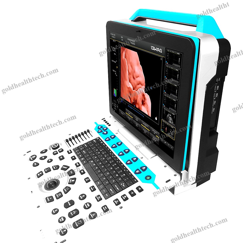 Color Doppler Ultrasound System