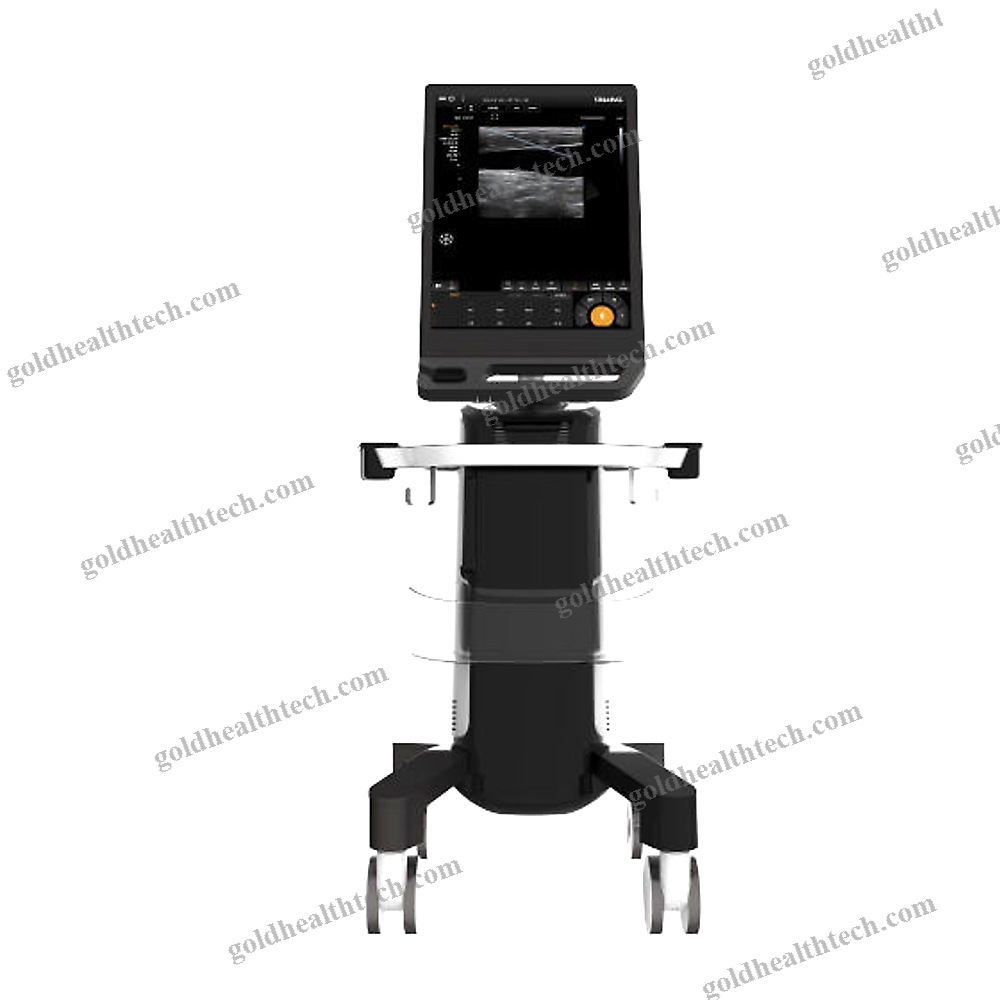 On-Platform, Compact Ultrasound System
