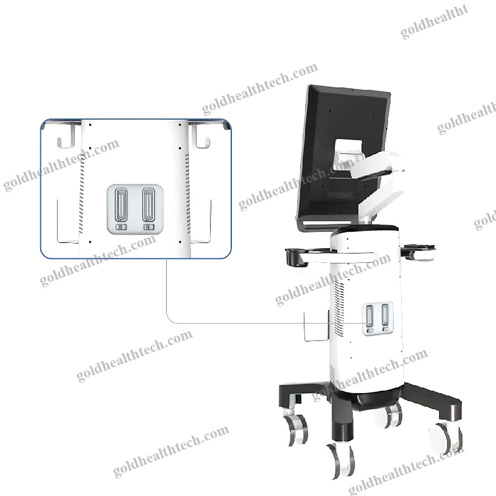 On-Platform, Compact Ultrasound System