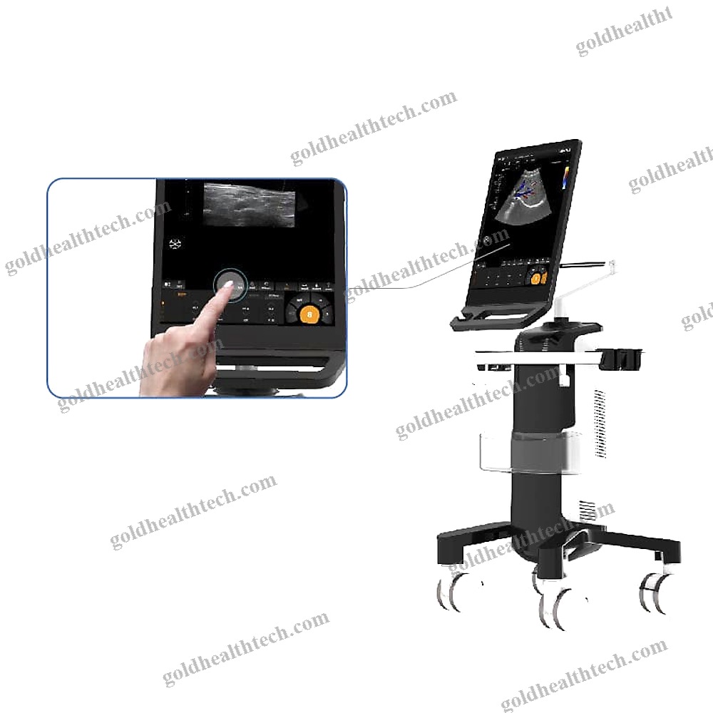 On-Platform, Compact Ultrasound System