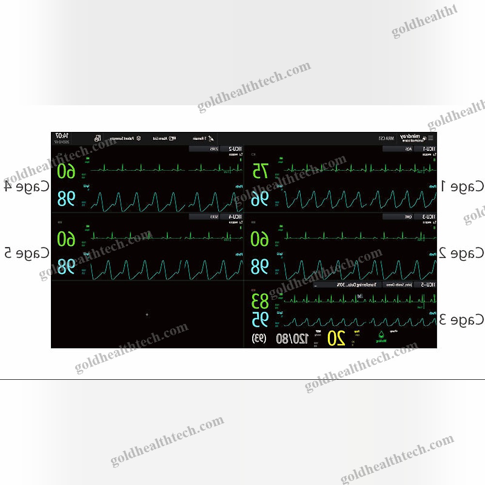 Cardiology Telemetry System