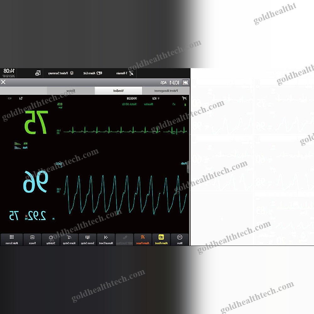 Cardiology Telemetry System