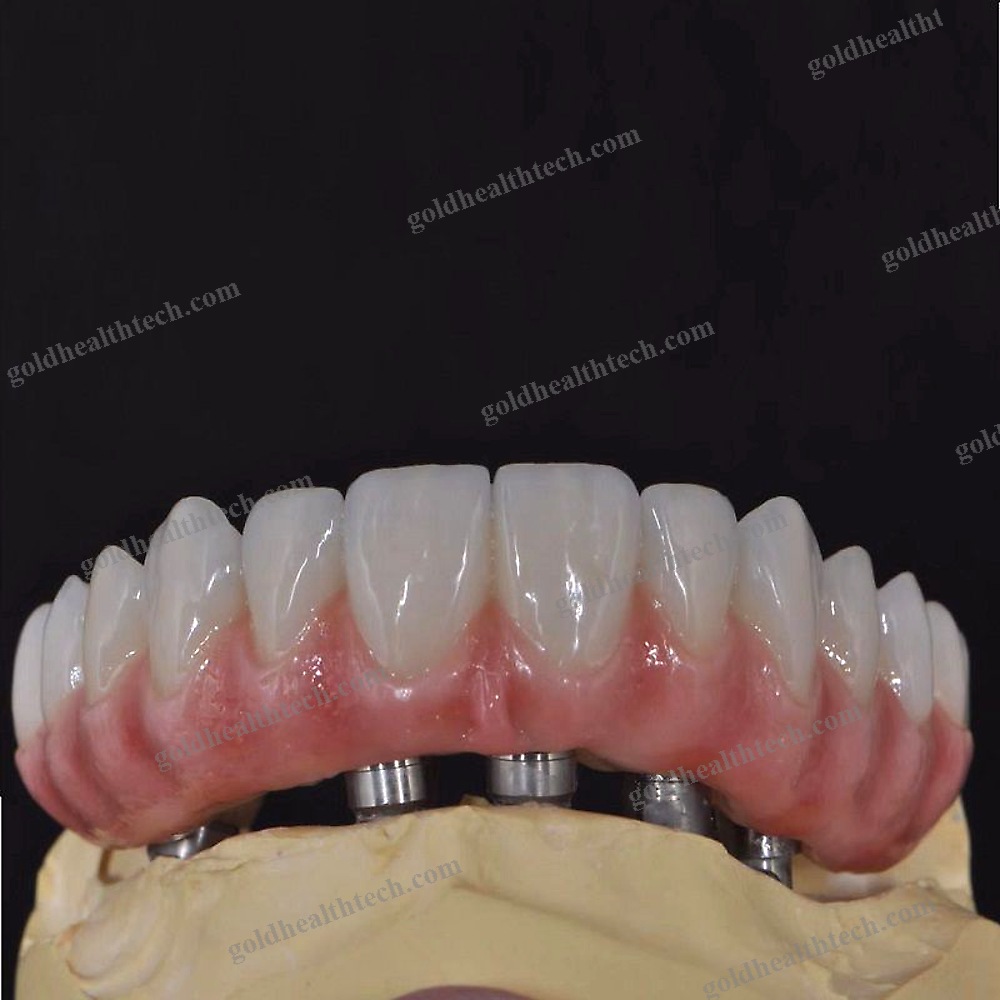 Zirconia Dental Material