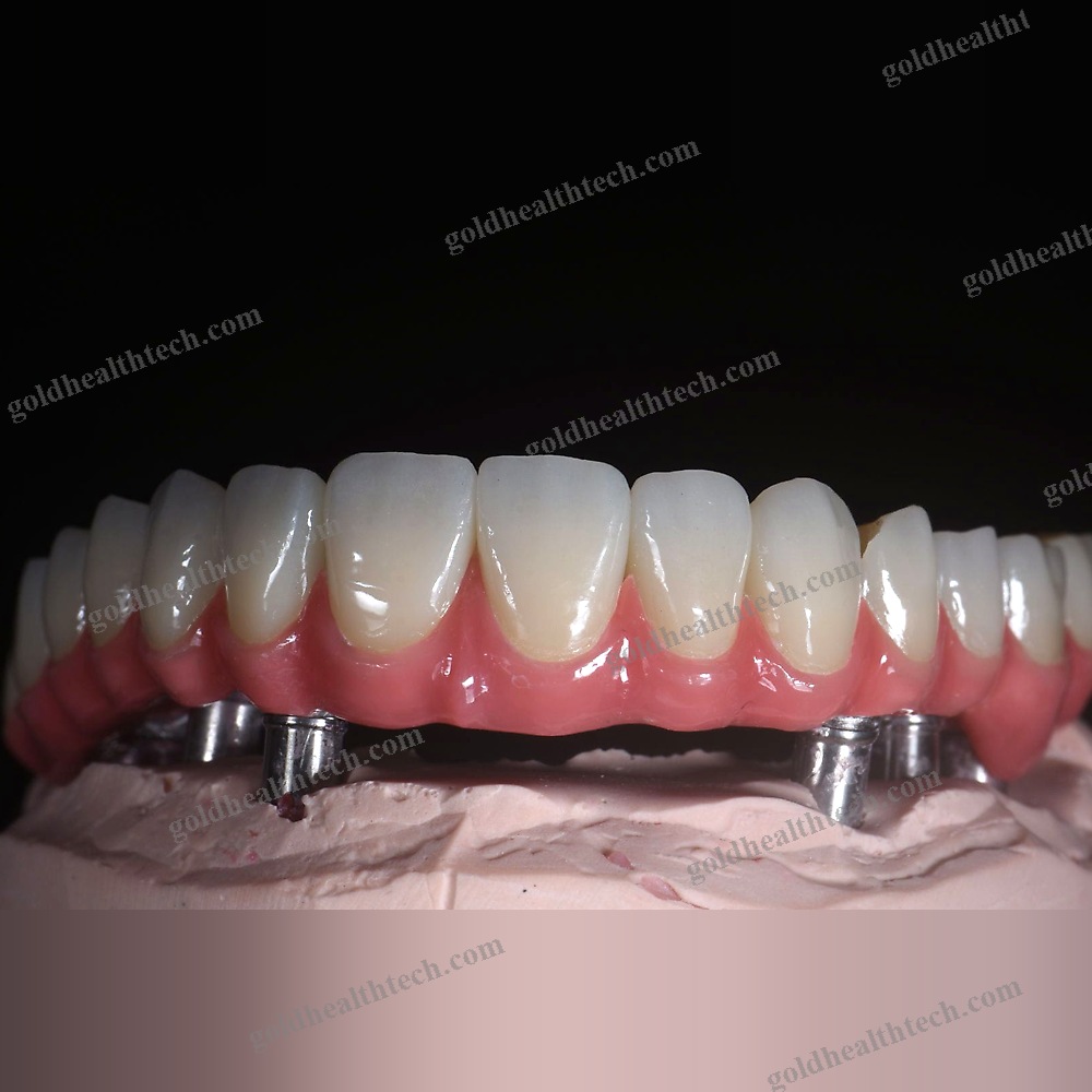 Zirconia Dental Material