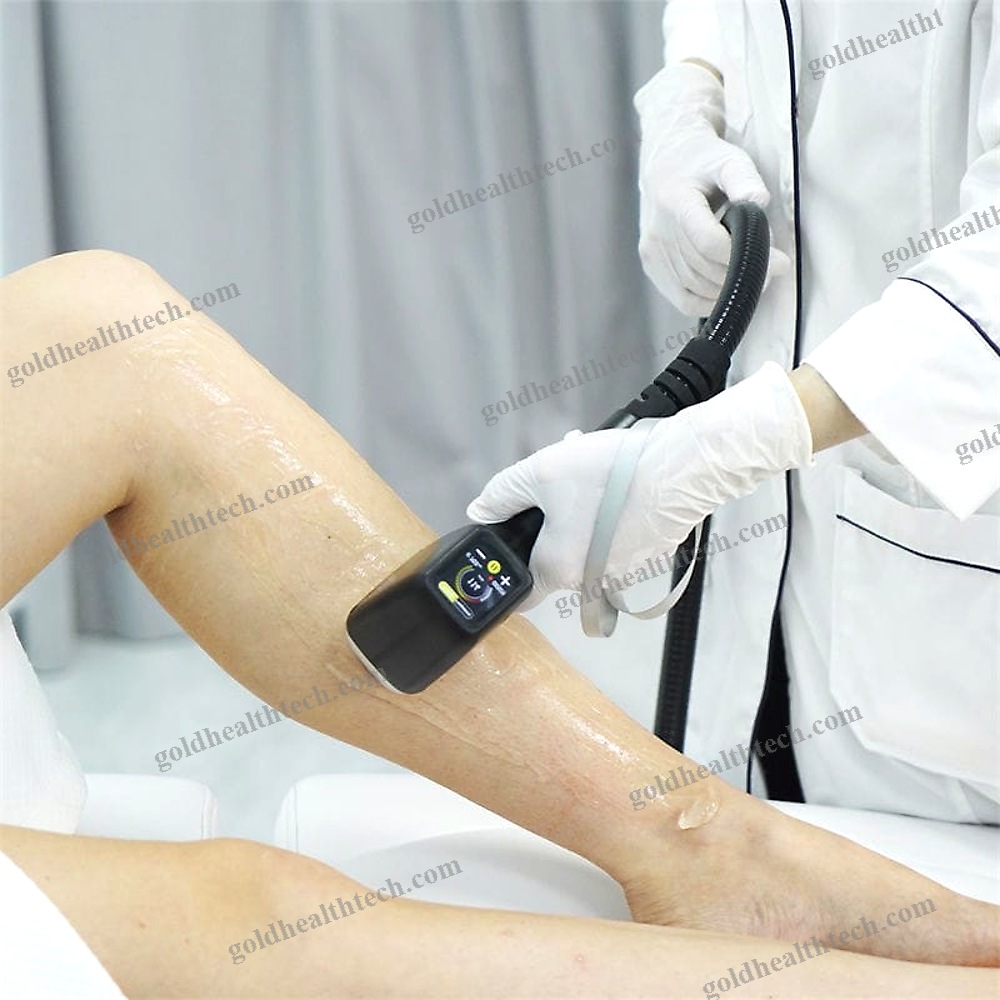 Pigmented Lesion Treatment Laser