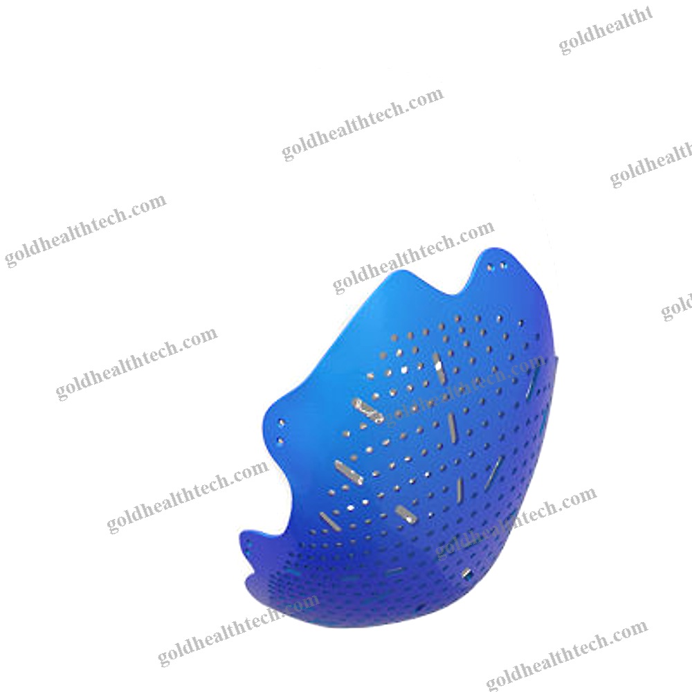 Custom-Made Cranial Implant
