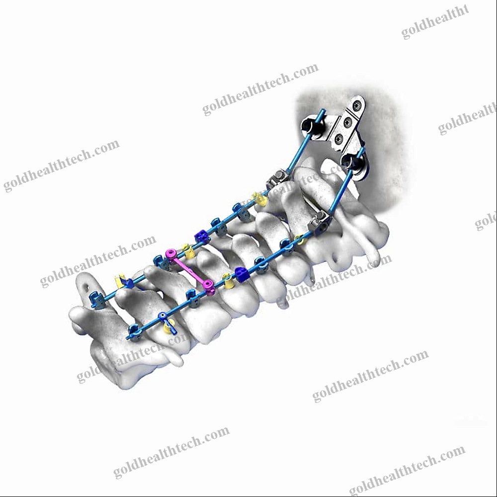 Occipito-Cervical Osteosynthesis Unit