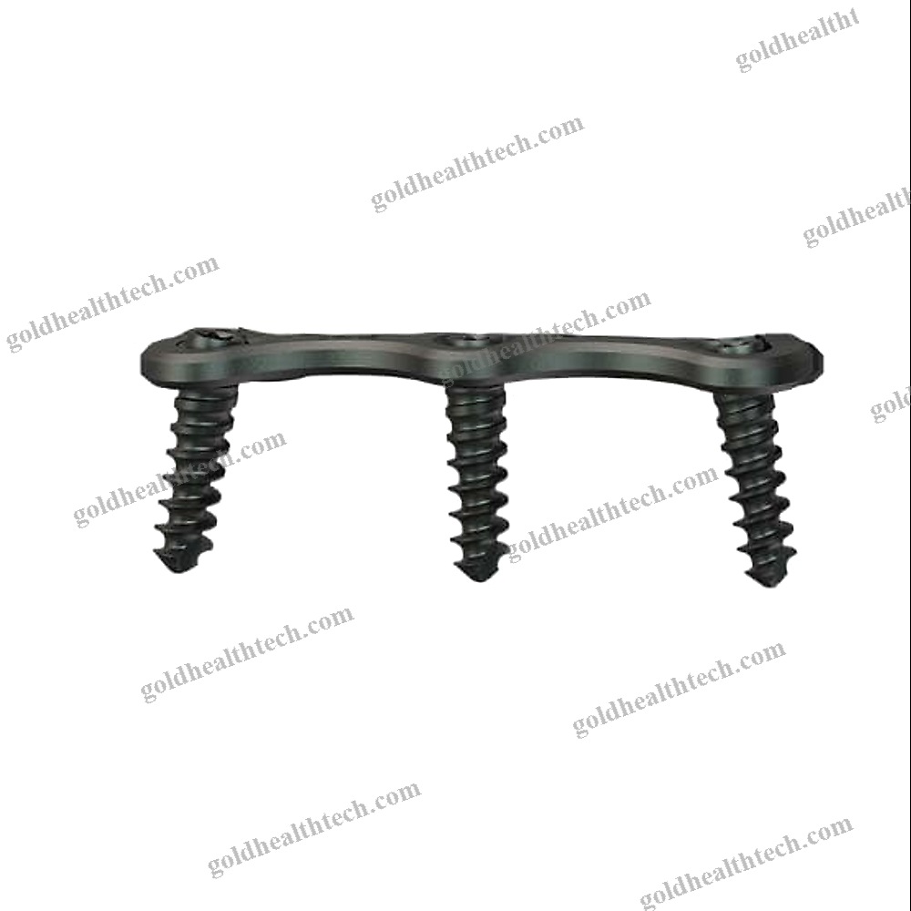 Cervical Arthrodesis Plate