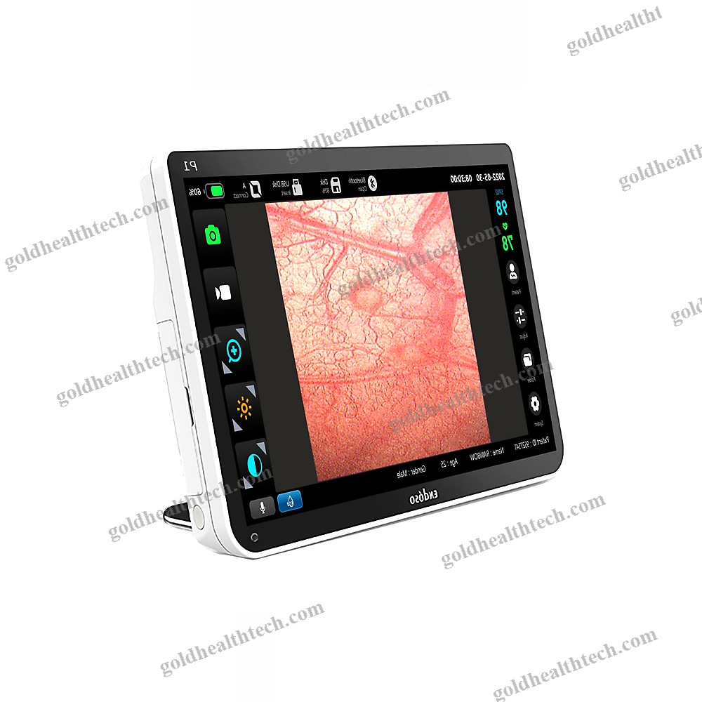 High-Definition Video Cystoscope