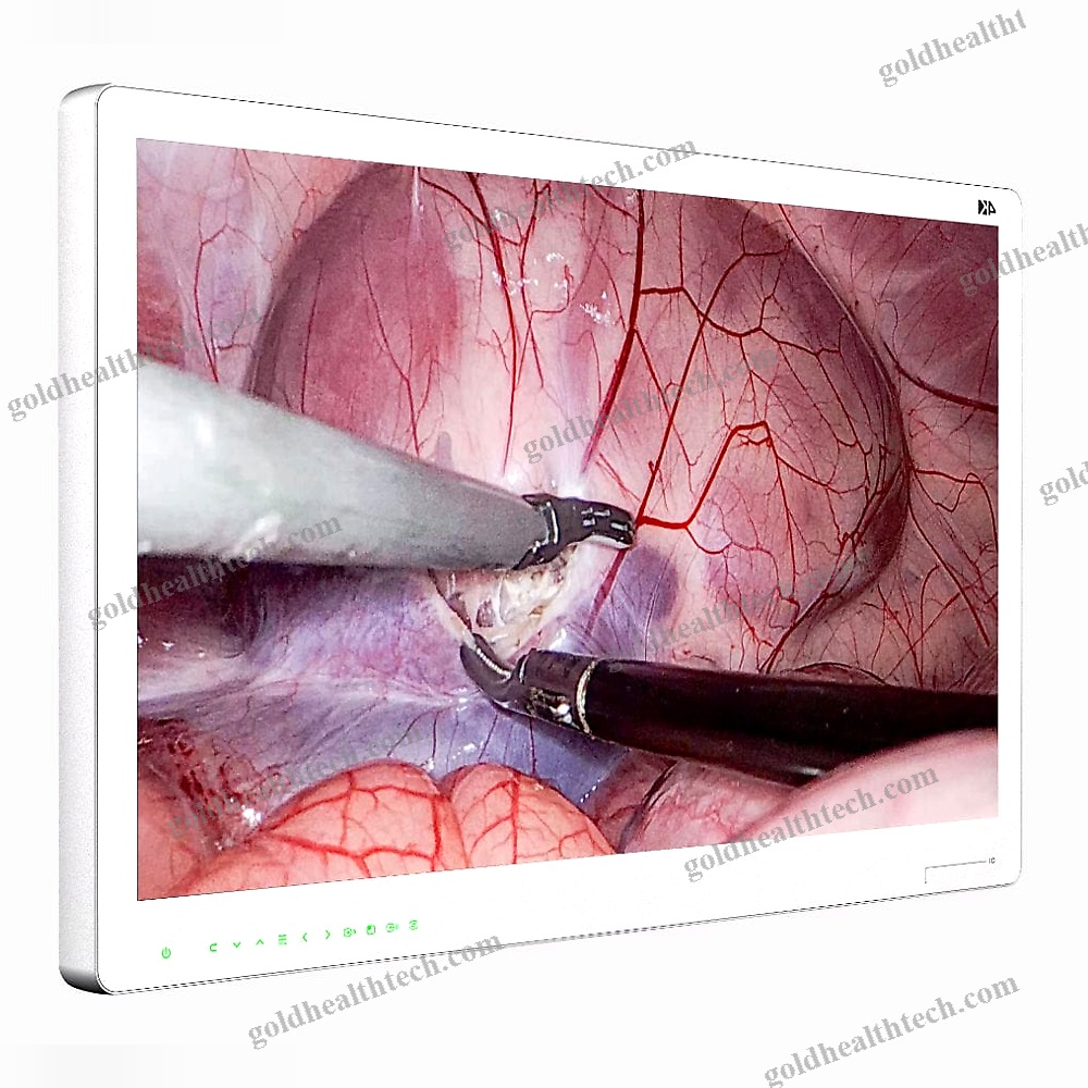 Surgical Display