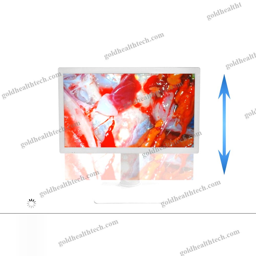 Operating Room Display
