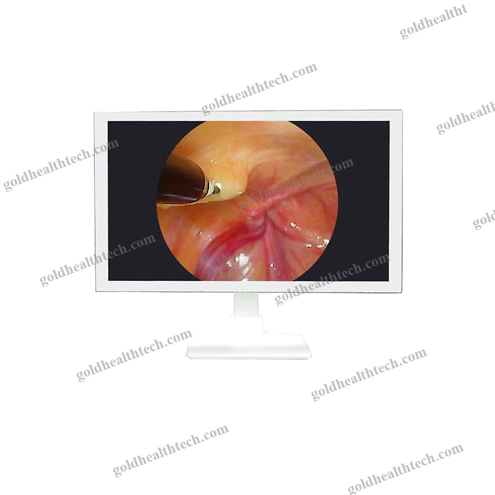 Operating Room Display