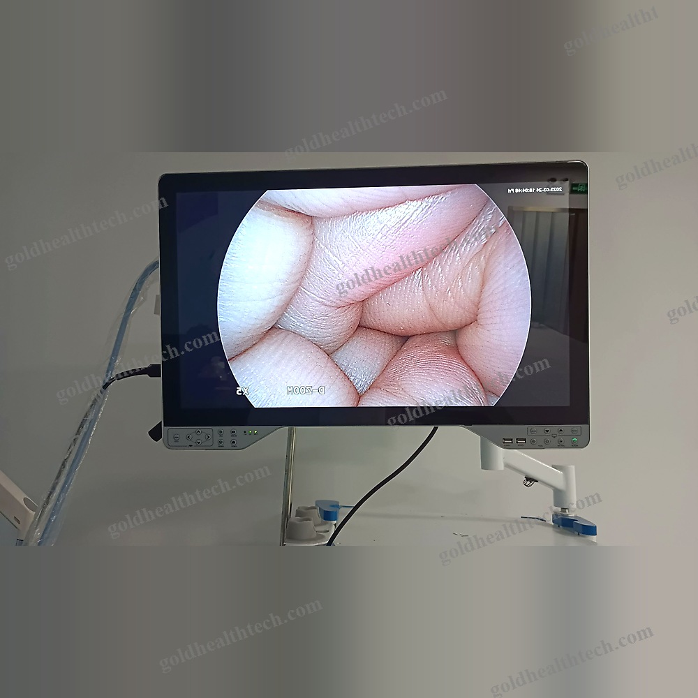 Medical Camera