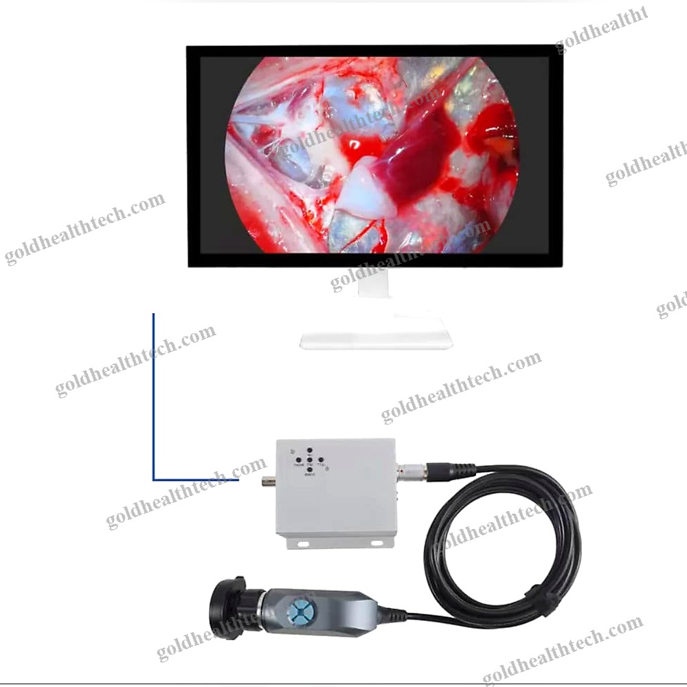 Endoscope Camera