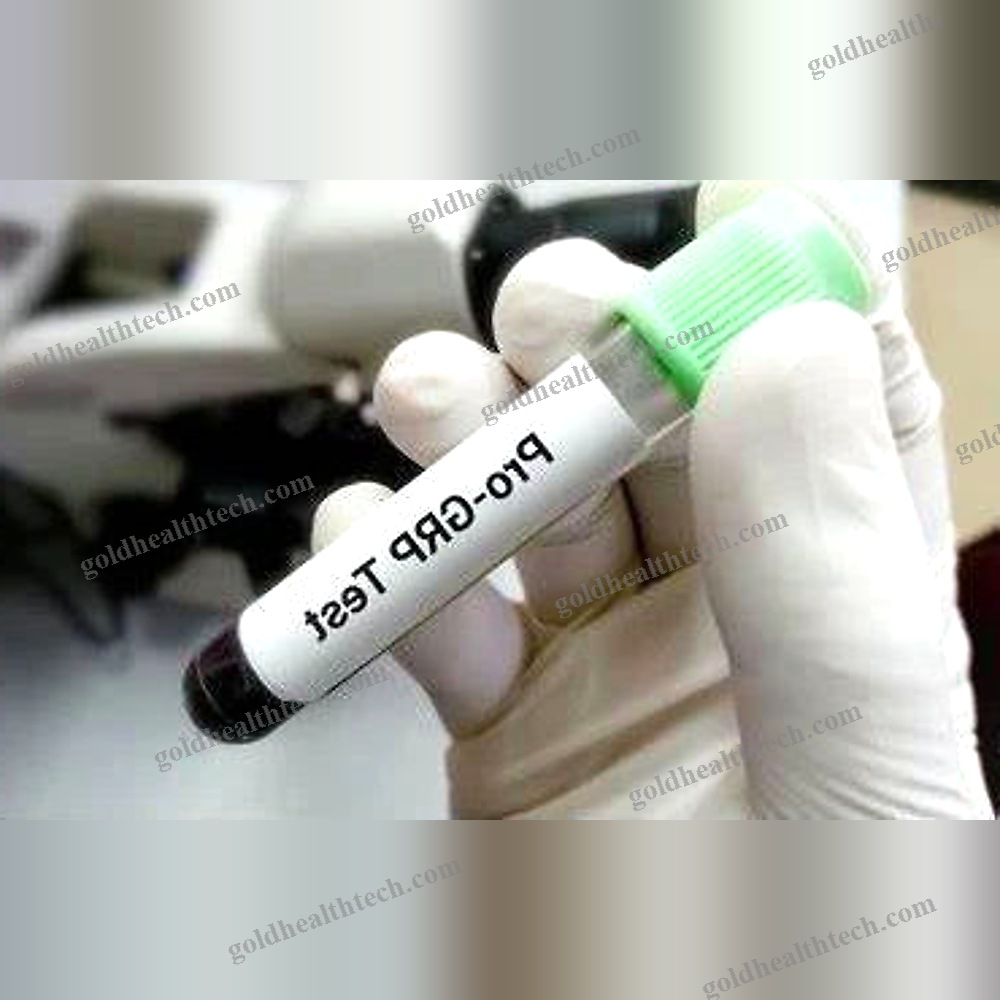Lung Cancer Test Kit