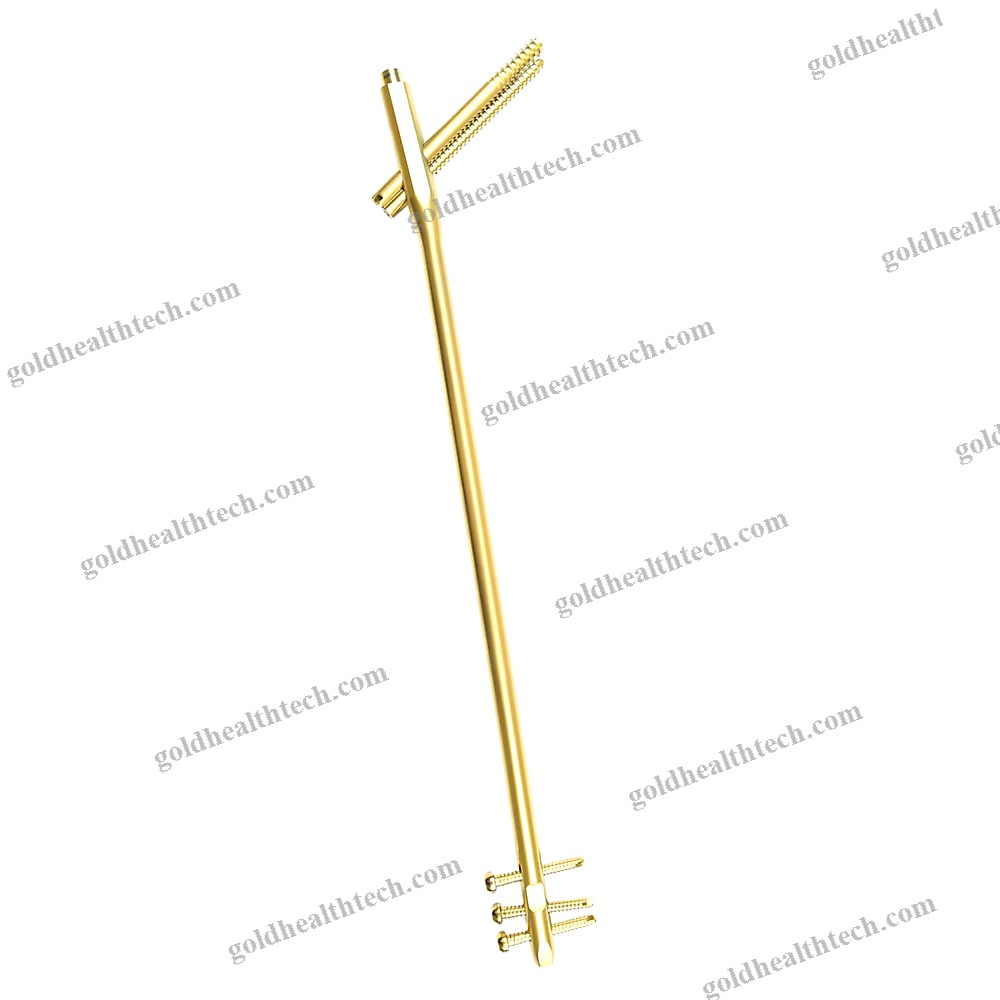 Femoral Intramedullary Nail