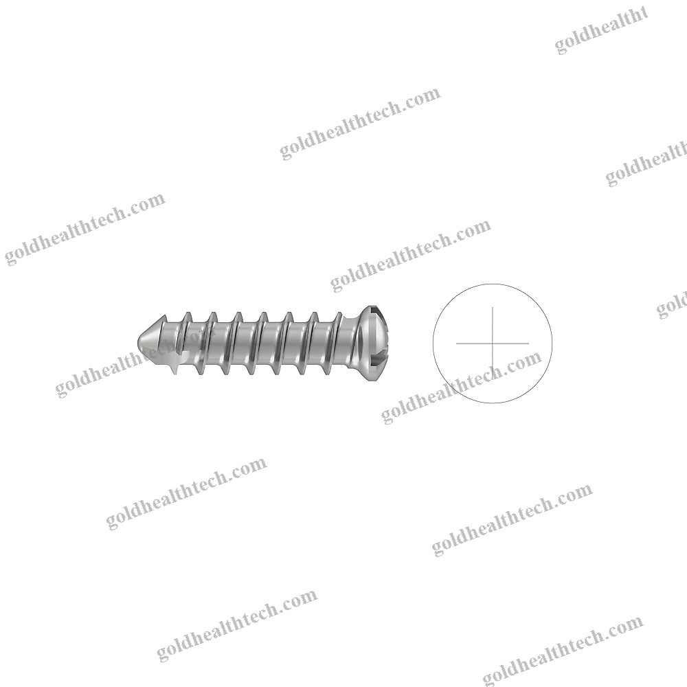 Vertebra Laminoplasty Plate
