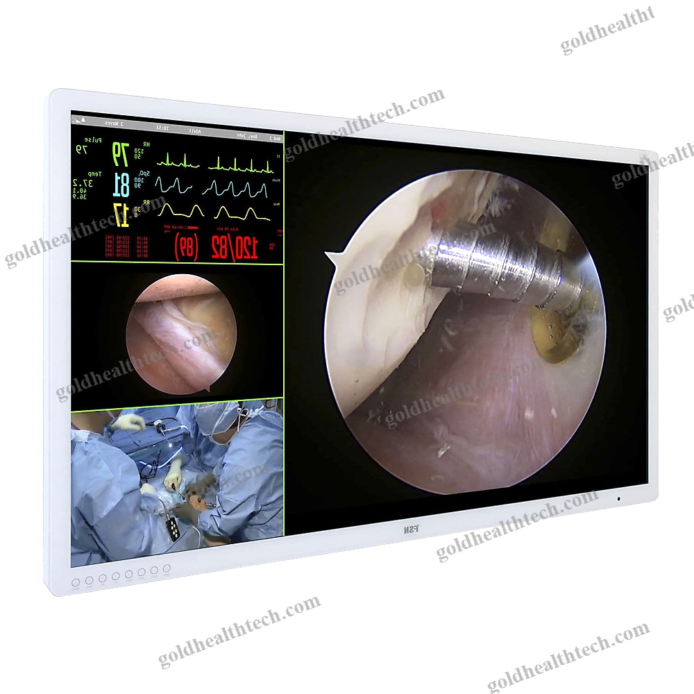 Diagnostic Display