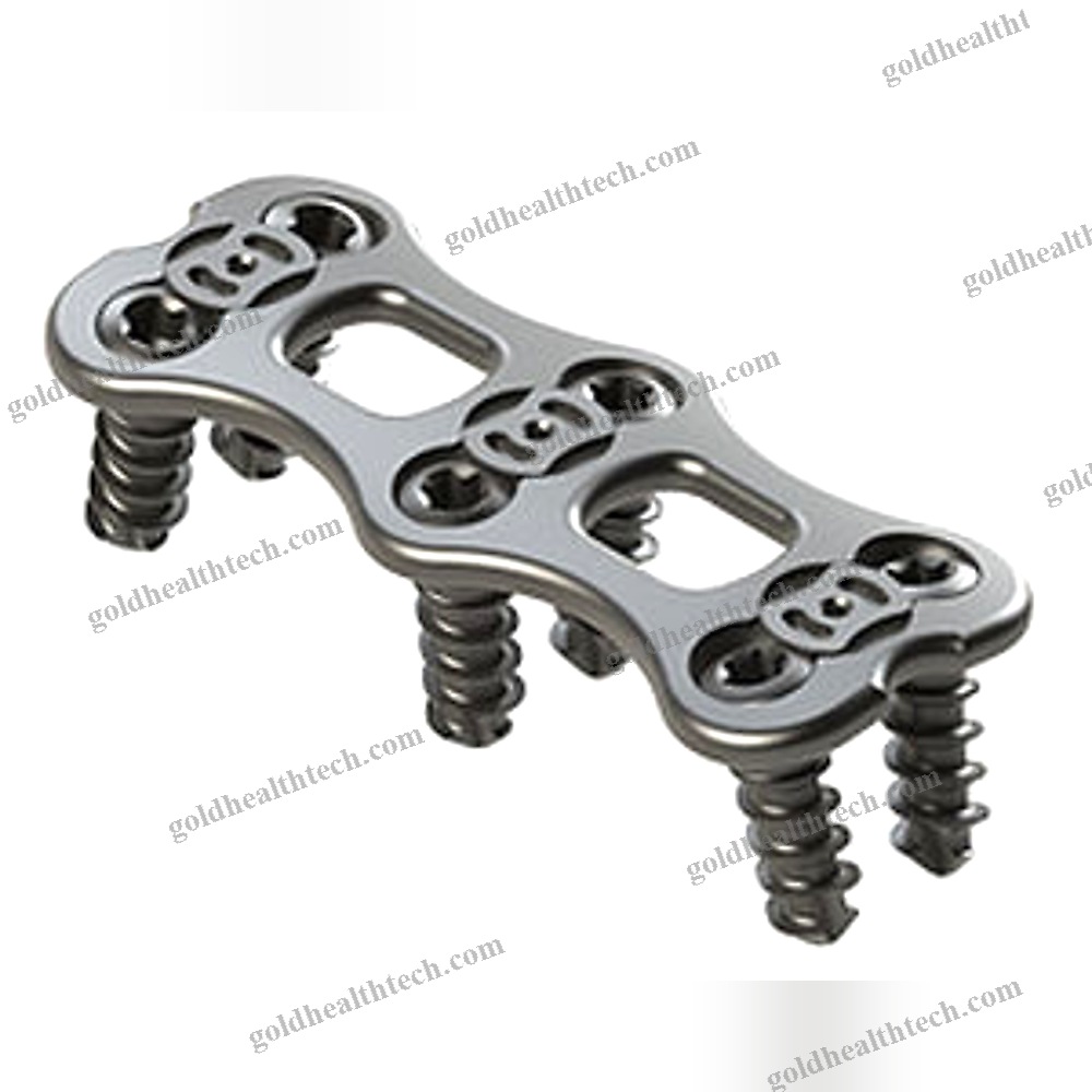Cervical Arthrodesis Plate