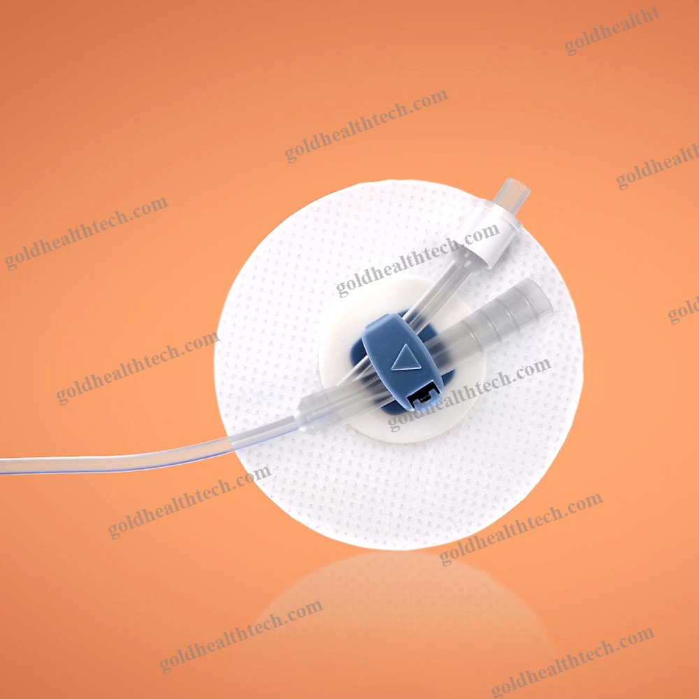 Urinary Drainage Catheter Band