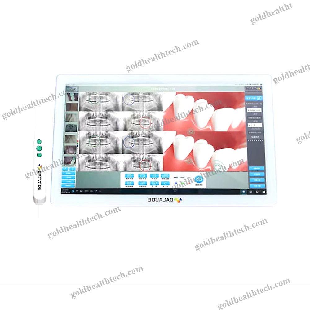 Intraoral Camera