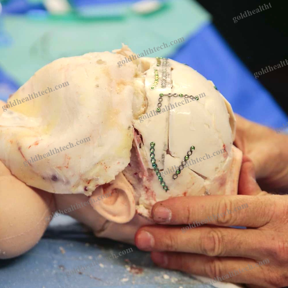 Craniotomy Simulator