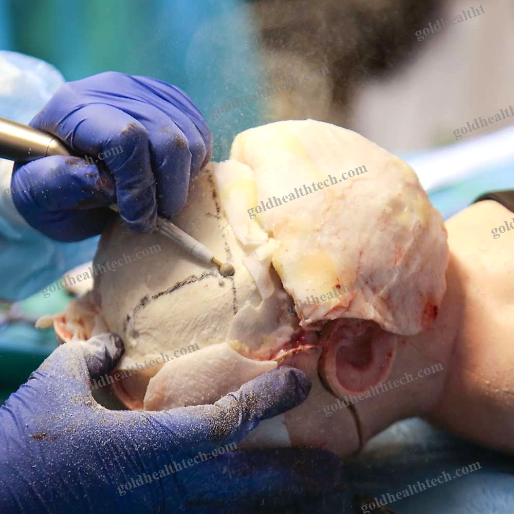 Craniotomy Simulator