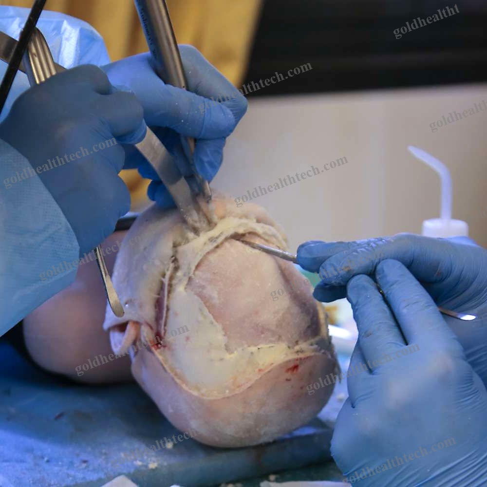 Craniotomy Simulator