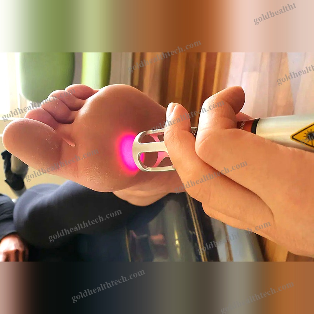 Podiatry Laser