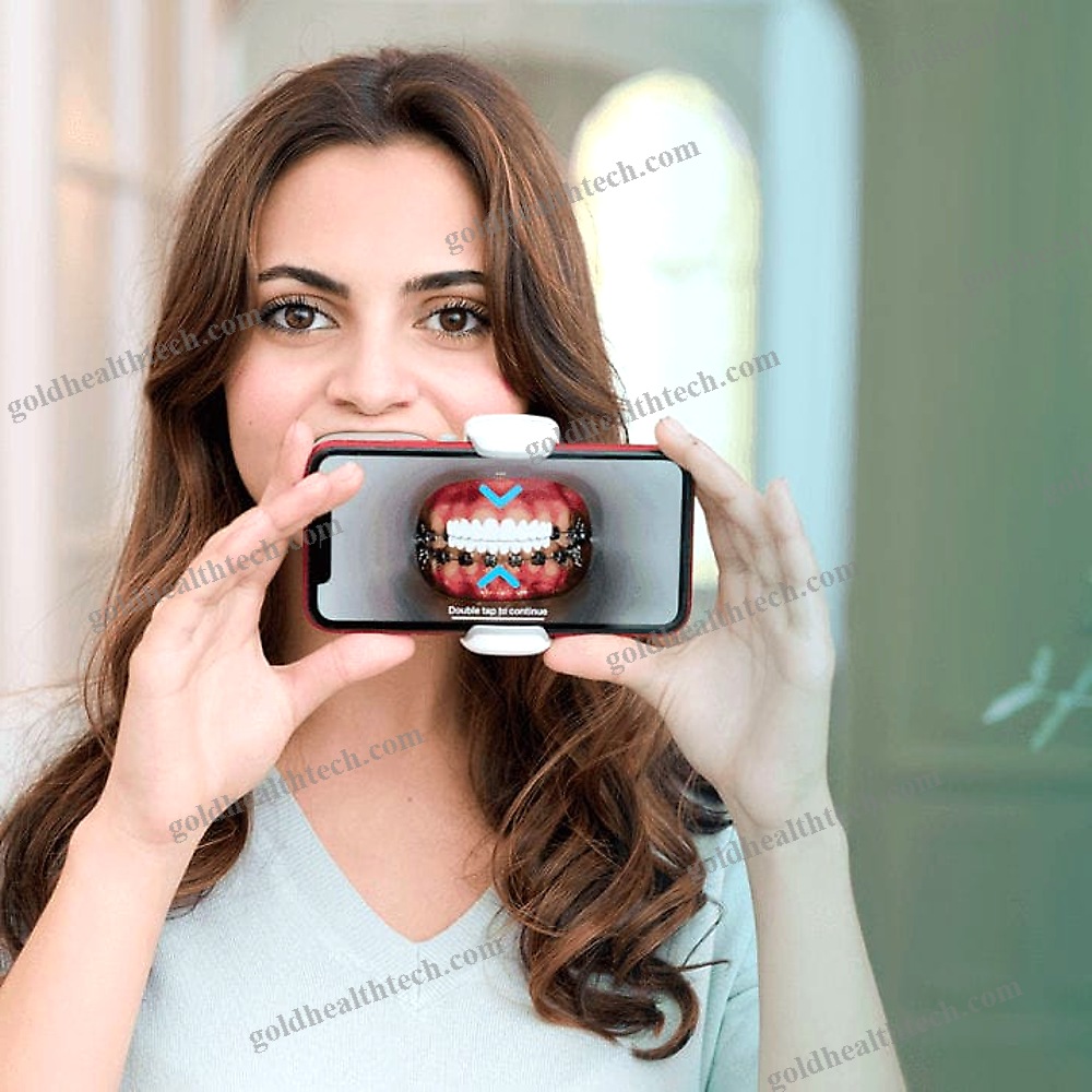 Dental Camera