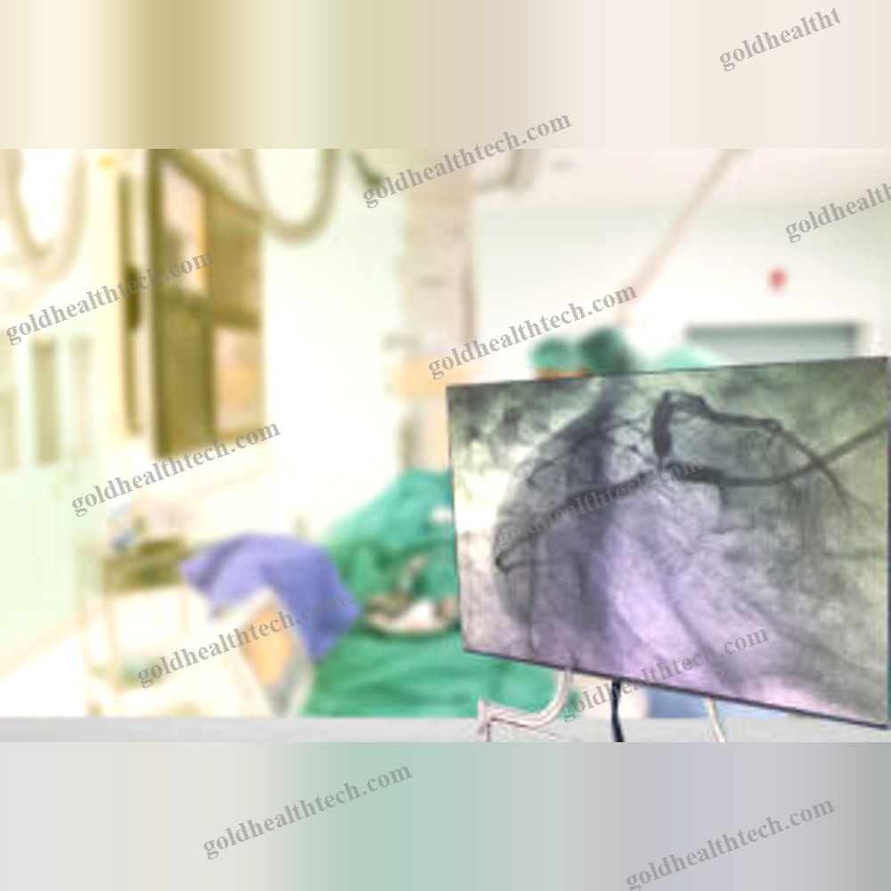 Minimally Invasive Surgery Robot