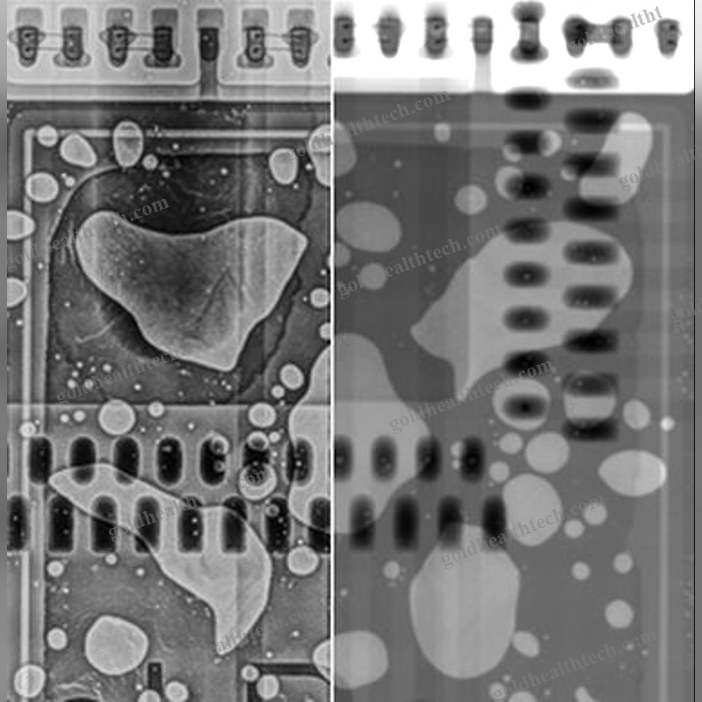 X-Ray Inspection System
