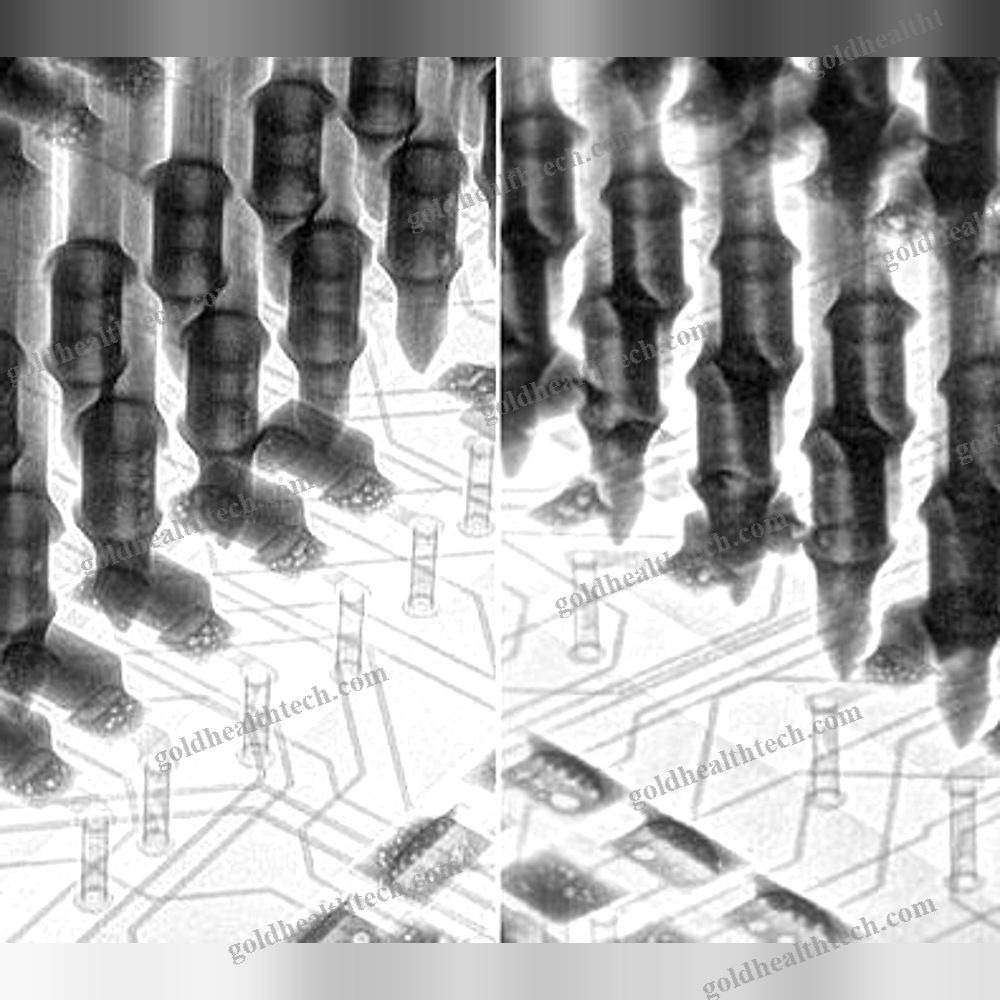 X-Ray Inspection System