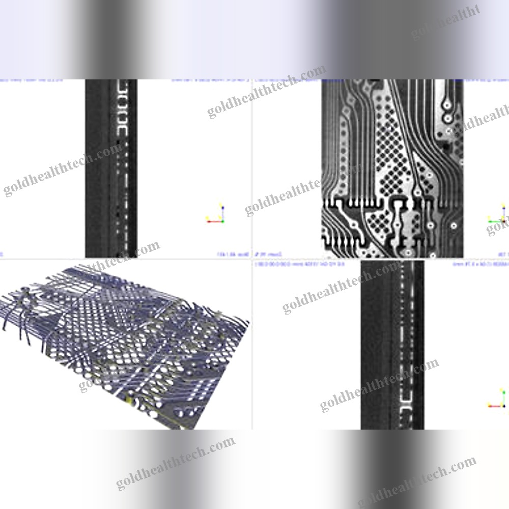 X-Ray Inspection System