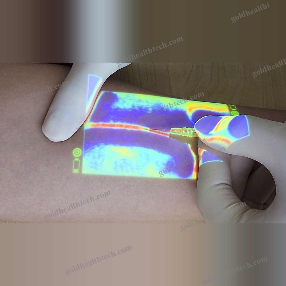 Led Vein Viewer